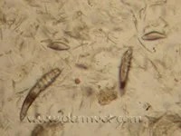 Microscopic view of demodex mites and eggs from a dog skin scraping at a veterinary dermatology clinic in Lacey
