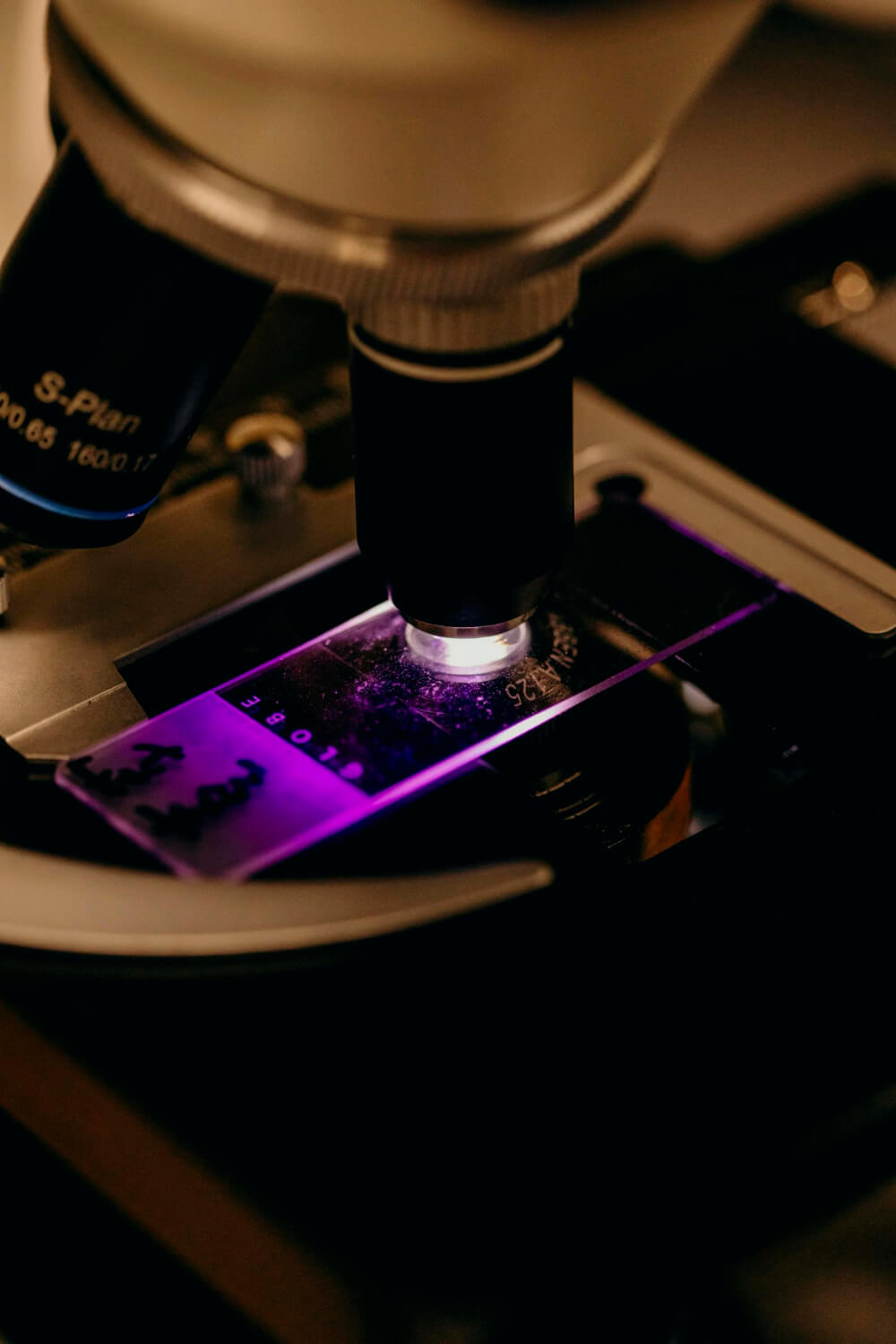 Close-up of a microscope examining a stained skin slide for immune-mediated and autoimmune disease diagnosis in Lacey