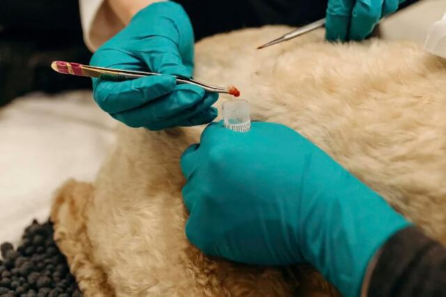 Biopsy & Dermatopathology